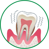 口内フローラを調べ歯周病の治療と予防に
